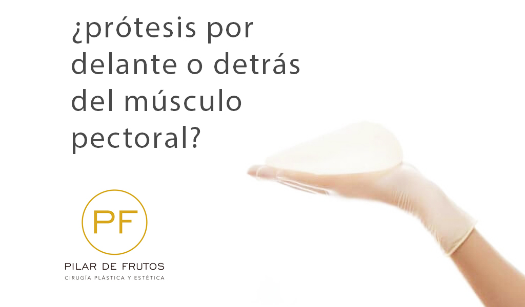 Prótesis mamarias ¿por delante o detrás del músculo pectoral?