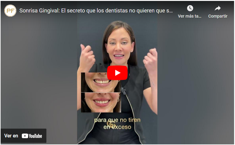 sonrisa gingival pilar de frutos