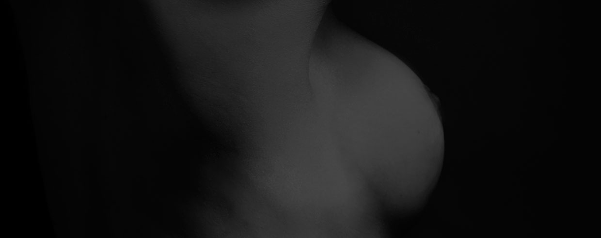 Mastopexia
