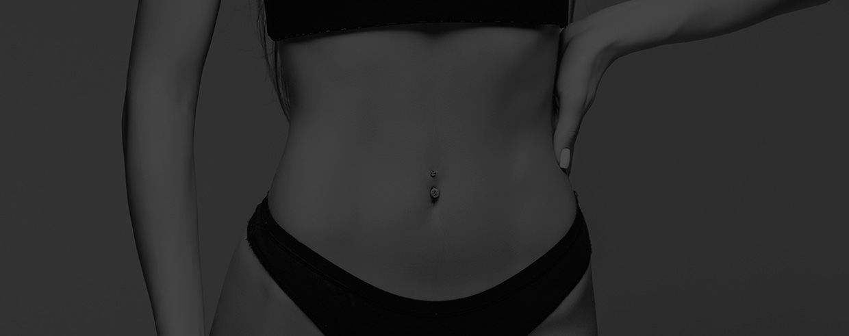 Abdominoplastia